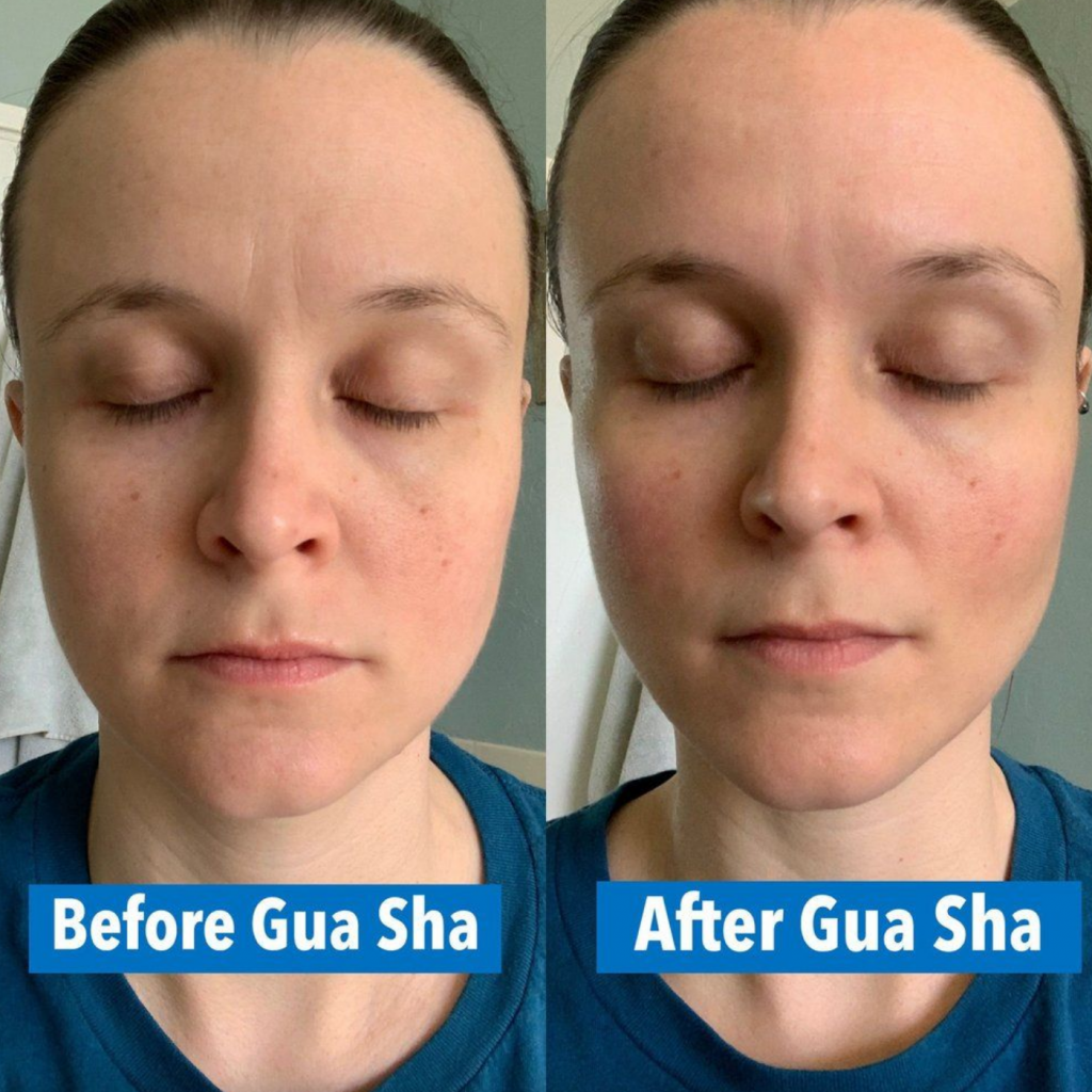 Gua Sha: Before and After Pics! | CelebrityStyleGuide